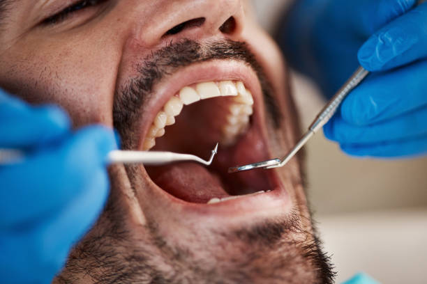 Fast & Reliable Emergency Dental Services in OK